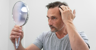 Hair thinning